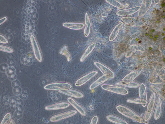 Protozoa