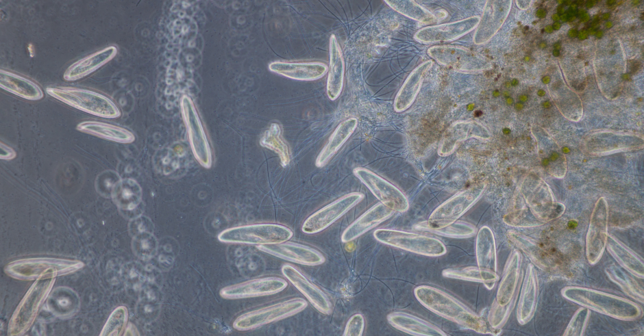 Protozoa